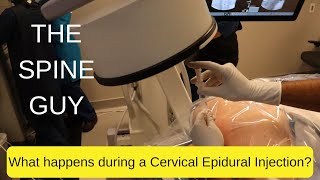 What happens during a Cervical Epidural [upl. by Ahsehat]