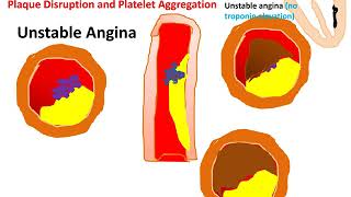 The Pharmacology of The Vasodilators amp The Treatment of Angina Pectoris 1 [upl. by Boccaj12]