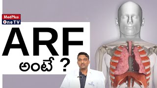 What is Acute Respiratory Failure   ARF Symptoms  DrRaja Manohar Acharyulu MedPlusONETV [upl. by Butcher]