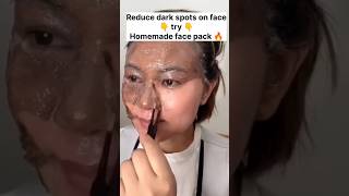 Overnight Acne Treatment😌 Remove Pimple and Acne Overnight shorts youtubeshorts pimple acne [upl. by Annotahs]