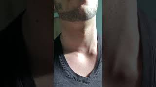 My visible neck pulse [upl. by Modnarb]