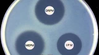 CARBAPENEMS  Doripenem Mechanism of Action [upl. by Barny644]