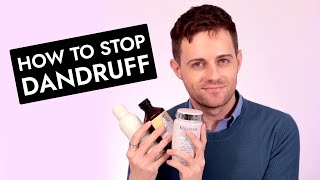 Heres how I fixed my itchy flaky scalp  AntiDandruff hair routine [upl. by Eagle]