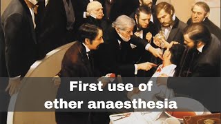 16th October 1846 First public demonstration of ether anaesthesia [upl. by Gonta460]