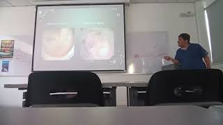 PT ABDOMEN CLASE 12 PARTE 3 [upl. by Sidras510]