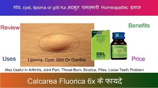 Calcarea Fluorica 6x गांठ का रामबांड इलाज Review amp Explain in 2022 [upl. by Armahs]