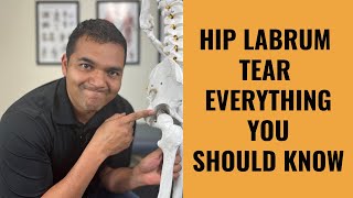 Hip Labrum Tears  Everything You Absolutely Need To Know [upl. by Inaej]