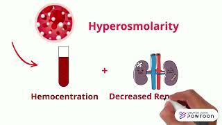 8 Hemoconcentration [upl. by Emmie457]