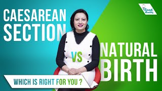 CaesareanSection vs Natural Birth Which Is Right for You ft Dr Sunita Bhandari  EP 35 [upl. by Nij911]