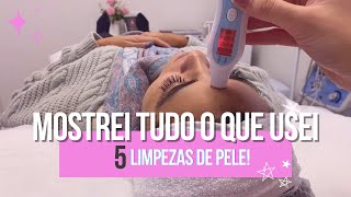 5 LIMPEZAS DE PELE  PRODUTOS QUE UTILIZEI [upl. by Norven]