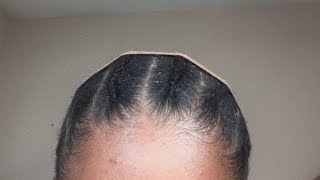 EASY FLAT BRAIDS FOR UNDER WIGS [upl. by Ahsienot908]