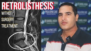 Retrolisthesis L5S1 chiropractic treatment india by Dr Sakibul Hasan [upl. by Onihc700]