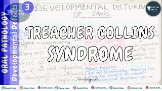 Treacher Collins Syndrome  Mandibulofacial Dysostosis  Dev disturbances of jaw  Dr Paridhi [upl. by Yerfoeg]