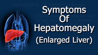 Symptoms Of Hepatomegaly Enlarged Liver [upl. by Eiralih]