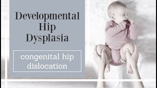 Developmental Hip Dysplasia  congenital hip dislocation [upl. by Combes]