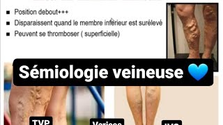 Sémiologie veineuse  Examens des veines jugulairesMITVPmesure de pression veineuse [upl. by Esyla]