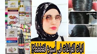 تجربتي مع فاسترتوم لفراغات الشعر ووقف تساقط الشعر نهائياً في أسبوع فقطfaster oilex light serum [upl. by Deana]