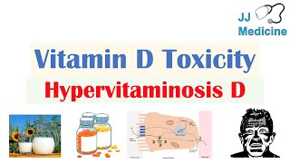 Vitamin D Toxicity Hypervitaminosis D  Causes Pathophysiology Symptoms Diagnosis Treatment [upl. by Licht]