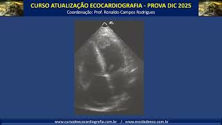 TREINAMENTO EM VIDEOS DE CARDIOPATIA ISQUÊMICA [upl. by Aicilef]