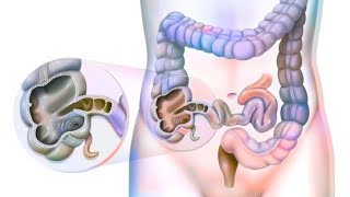 Large intestine  Caecum amp Appendix Part 2 [upl. by Claretta]