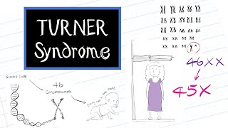 What is Turner Syndrome HealthSketch [upl. by Suirada]