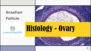 Ovarian Follicles  Histology made easy [upl. by Ahtar]