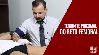 Tendinite Reto Femoral CUIDADO COM A ARTÉRIA [upl. by Colley]