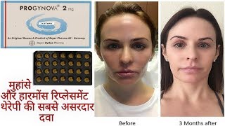 PROGYNOVAEstradiol2mg Tabletमुंहासे और हारमोंस रिप्लेसमेंट थेरेपी की सबसे असरदार दवा Full Review [upl. by Marlin]