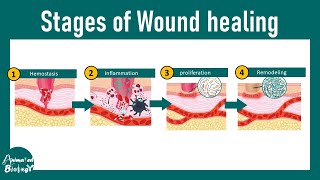 Wound healing stages  steps of wound healing  Wound healing and injury [upl. by Tena]