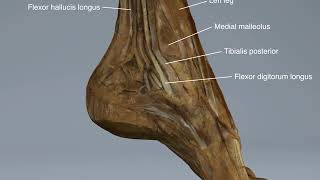 Tarsal tunnel dissection [upl. by Newlin]