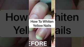 Nail Hack To Whiten Yellow Nails [upl. by Jews]