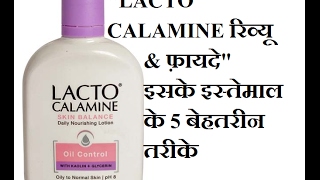 Lacto Calamine Skin Care Lotion Review  Top 5 uses of Lacto Calamine [upl. by Parent]