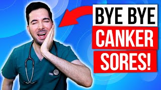 How to get rid of canker sores inside your mouth fast and treatment [upl. by Jary]