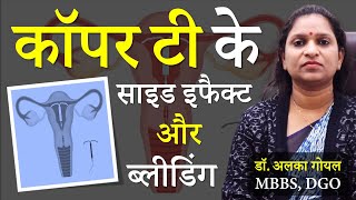 कॉपर टी के नुकसान और फायदे  Copper T Kaise Lagai Jaati Hai  Copper T Side Effects in Hindi [upl. by Talanian]