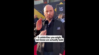 6 Celebrities You Never Knew Were Actually Bald Surprising Celebrity Transformations Revealed [upl. by Enialehs101]