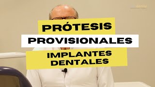 La importancia de los provisionales para los implantes dentales [upl. by Geminian]