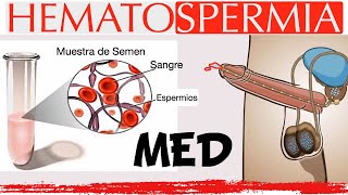 Hematospermia en menos de 2 minutos [upl. by Amekahs]