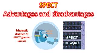 SPECT Advantages and disadvantages [upl. by Matless]