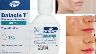 Dalacin T lotion remove acne Clindamycin phosphate  review [upl. by Selden52]