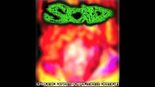 Scid  Chronic Disembowelment Full Demo [upl. by Takashi130]