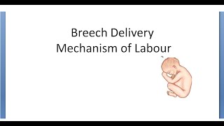 Breech Presentation Final Part 3 Labour Management Obstetrics [upl. by Teleya]