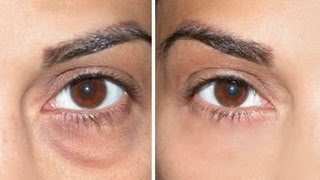 How to Cover Dark Circles  Under Eye Bags [upl. by Gambrell]