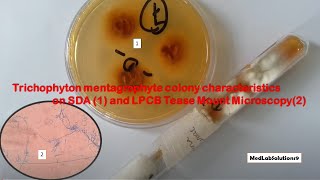 Trichophyton mentagrophyte colony characteristics on SDA and LPCB Microscopy [upl. by Talbert]