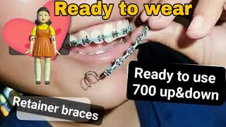 No To DIY Retainer Braces Ready to wear retainer like braces no gums Dont Buy it [upl. by Brande]