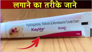 Kaylite Cream Uses Side Effects Price and Review Hindi [upl. by Uel]