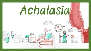 Achalasia esophageal in children Pathogenesis symptoms and treatment  Achalasia animation [upl. by Ferrand54]