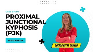 Case Study 131  Proximal Junctional Kyphosis  Explained by Dr Betsy Grunch neurosurgeon [upl. by Luthanen691]