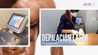 Depilación Láser en Hombres [upl. by Leahcir]