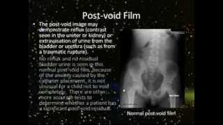 Cystography amp Urethrography  Part 1 [upl. by Maxey]