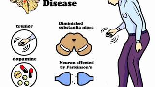 💚 physiology 🖤CNS 💛 Basal Ganglia 💚 [upl. by Eikcin979]